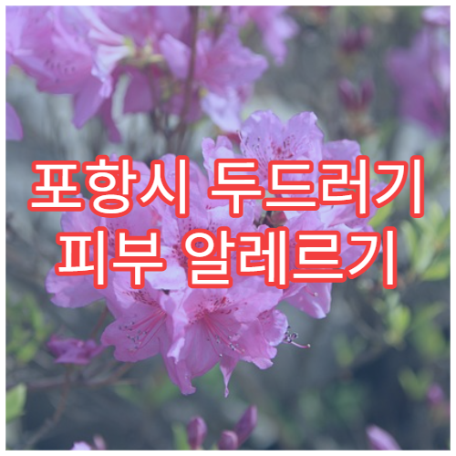 포항시 두드러기 피부 알레르기 약물 부작용 관리 피부과 병원